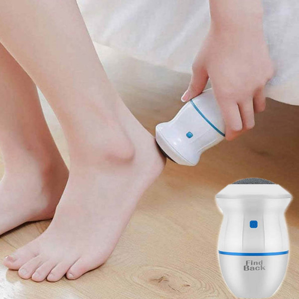 Уникална машинка премахваща мазоли Find Back Callus Remover